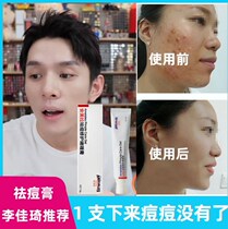 Anti-acne artifact Li Jiaqi acne-removing cream to lighten acne marks and acne scars