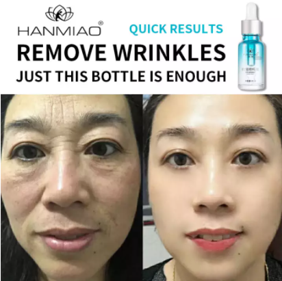 Hanmiao Official Store Anti-Wrinkle Serum Dark Spot Remover