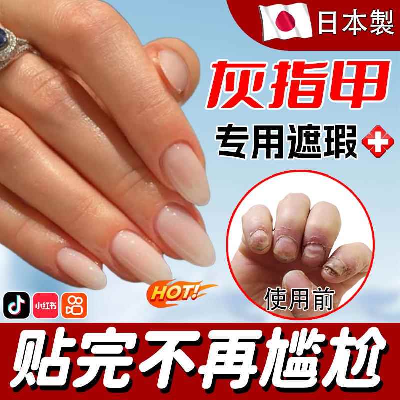 Almond-Shaped Toenail Concealer Patch for Men and Women, Specialized for Covering Toenails, Summer Cover-Up Magic for Hands and Feet Gx