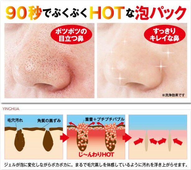 日本重曹去黑頭去除黑頭粉刺酒糟鼻草莓鼻去鼻子毛孔粗大白頭黑頭