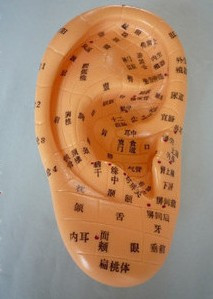 Acupuncture eardrum Acupuncture model Auricular point reflex zone model Wang Buliuyue