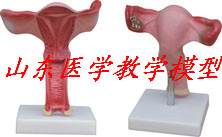 The model of the enlarged uterus is used in the
