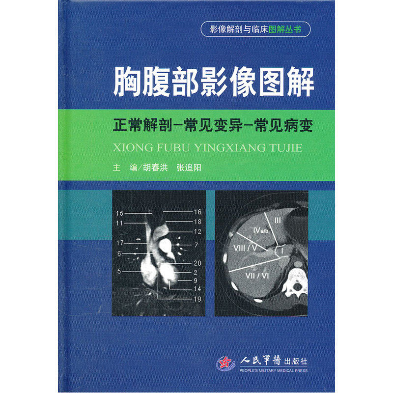 胸腹部影像图解(正常解剖-常见变异-常见病变)(精)/影像解剖与临床图解丛书 外科医学医疗知识 临床医学理论知识 正版畅销书籍
