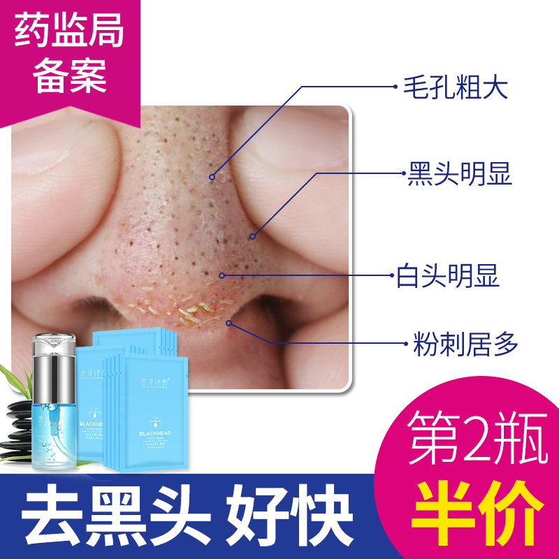 海洋诗韵去黑头收缩毛孔套装吸祛黑头导出液鼻贴粉刺控油男女学生