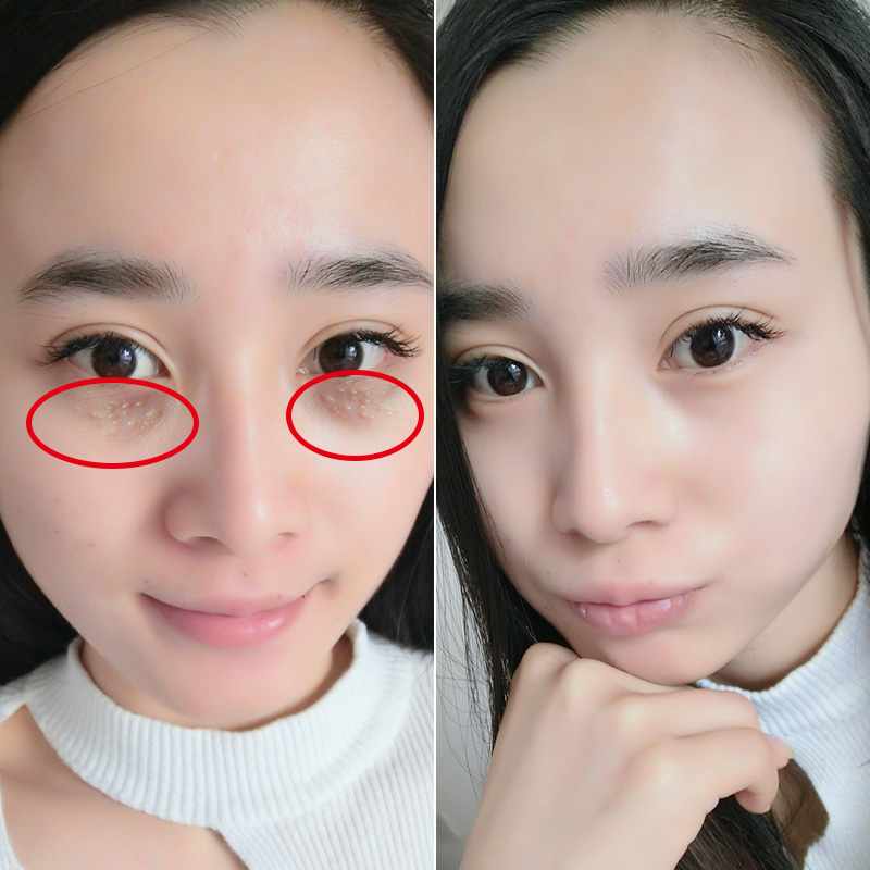 海洋诗韵眼霜去淡化黑眼圈眼袋细纹补水保湿提拉紧致抗皱眼部护理