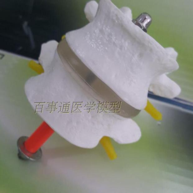 2节腰椎带椎间盘神经 医用教具 教学模型 人体骨骼模型 腰椎模型