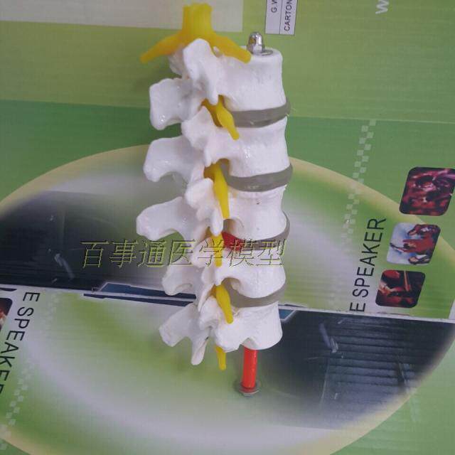 厂家直销 新款5节腰椎模型 腰椎骨骼椎间盘神经根模型 关节模型