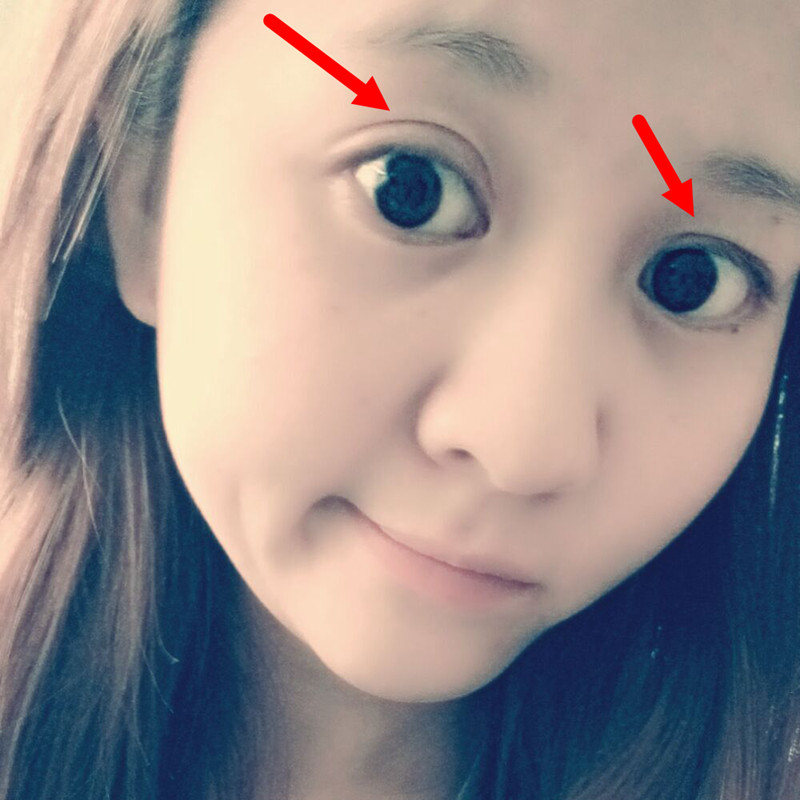 双眼皮定型霜 大眼神器持久隐形