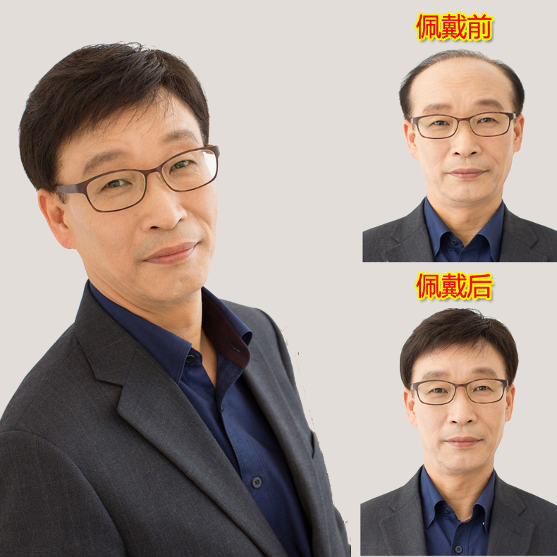 定做透气补发块逼真男士头顶假发块真发假发片无痕递针全手织