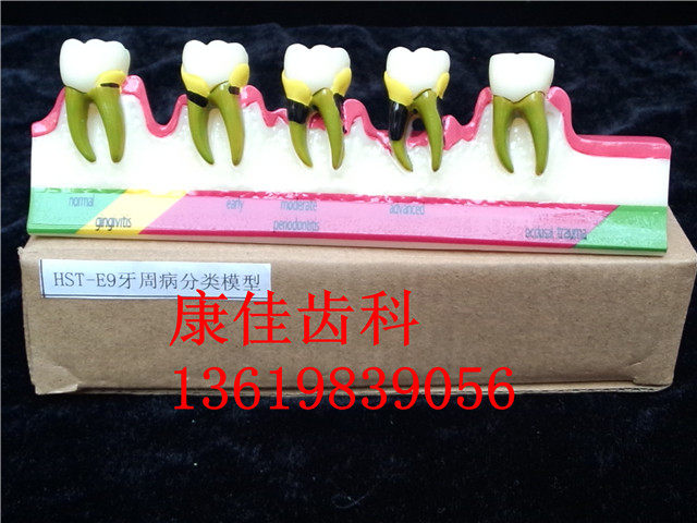 Dental Material Periodontal Decomposition Model Communication Explaining of Teaching Dental Oral Materials M8
