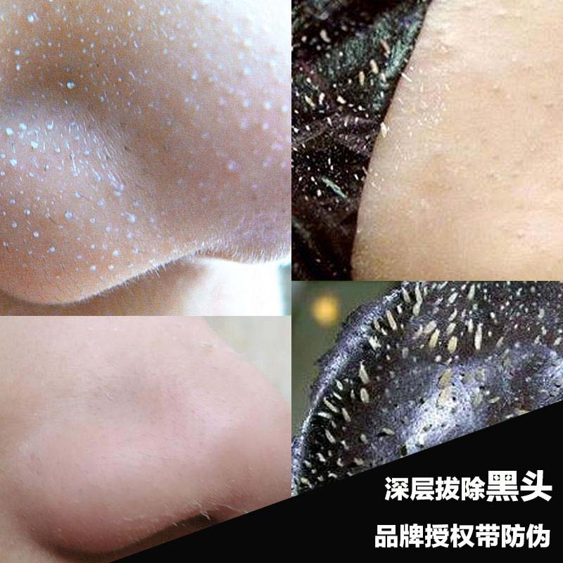 爱肤宜 竹炭吸黑头鼻膜贴 去黑头撕拉面膜 去黑头 收毛孔男女适用