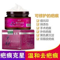 (Recommended by Xiaohongshu) Shitong Lavender Scar Cream 30g fades acne marks burn scars postpartum stretch marks