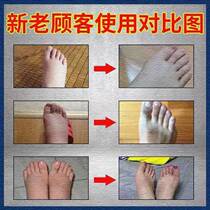 Diuretic Drainage and Swelling Patch to eliminate edema and remove edema in lower limbs. It is a magic tool to eliminate edema in the whole body. W to eliminate edema and remove swollen feet.