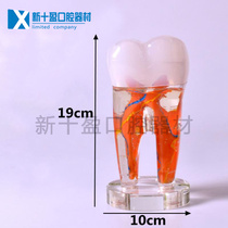 Dental decorations Open gift 10 times the teeth large tooth model clear cord dental neurological clinic wiring