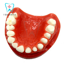 Dentistry Oral Teaching Half-Mouth Baked Porcelain Preparation Model Model Can Replace Dental Dentist Practice 