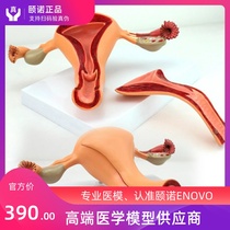 ENOVO Medical female internal reproductive organ model Uterus ovary reproductive structure Obstetrics and gynecology model