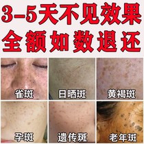 Whitening and freckle cream artifact to remove freckles chloasma freckles fade spots pigmentation melanin skin care products for men and women