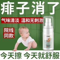 Prickly heat cream baby baby baby heat removal prickly heat cream baby child anti-prickly heat artifact to remove prickly heat to long wipe away