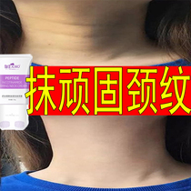 Neck line strong line cream Neck cream double roller v-shaped small iron neck Wei recommended recommended neck film beauty salon special to remove