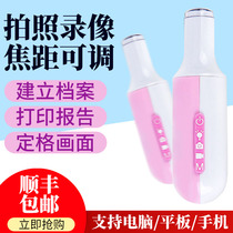 Colposcopy Gynecological endoscope Cervical examination mirror snooper Vaginal self-examination mirror HD vaginal endoscope