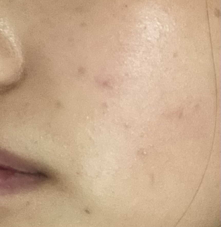 颐莲玻尿酸水乳套装怎么样，颐莲玻尿酸补水面膜怎么样