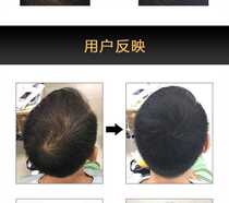 Fortitude Thickening Hair fiber spray Hair Drills Hair Chive Powder to Become Dense multitheist Divine Instrumental to Fill Up a Disposable Beauty Hair