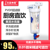 Han Blue God Shield Front Well Water Ultrafiltration Water Purifier Home Straight Drinking Kitchen Tap Water Groundwater Sediment Filter