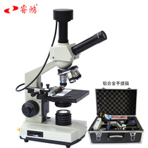 (Ruihong) Digital microscope connected to the computer TV shows a drop of blood testing instrument sub-health to see mites