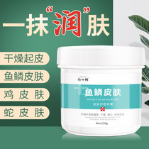 Dry skin skin body milk moisturizing and moisturizing goose bumps hair follicles keratinizing snake skin to fish scales cream