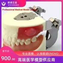 ENOVO Dental Practice exam Abscess incision and dental preparation model Alveolar abscess incision drainage