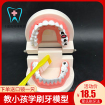 Toddler Teeth Toy Model Kindergarten Teaches Toothbrushing Model Tooth Decay Model Pathology Send Toothbrush (3 pieces)