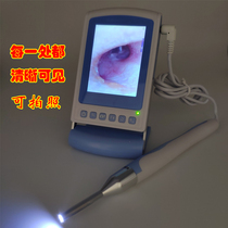 66C can take pictures surface detector visual ear picking equipment high-definition professional instrument ear digging tool 3 9mm