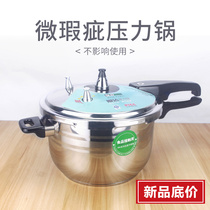 Leakage micro defective product pressure cooker Shunda 304 stainless steel pressure cooker gas cooker induction cooker Universal
