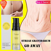 Stretch marks repair postpartum fade Stretch marks Stretch marks repair cream postpar