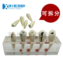 Tooth Root Canal Model Root Canal Repair Tooth Model Dental Pulp Endodontic Tooth Pathological Root Canal Repair Model