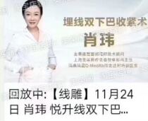 Xiao Wei buried thread double chin tightening beauty HD