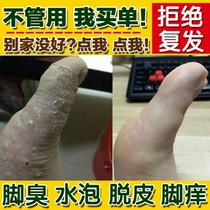 Thai spray foot itching toe slit peeling cracked skin frothing pillager sole dry cleft cream