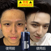 Mens face becomes handsome (device) Zun Blue mens bb cream Makeup cream Mens suit natural color foundation liquid special concealer