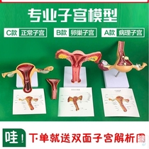 Female internal reproductive organ anatomical model Medicine human uterus vagina ovary fallopian tube mold simulation teaching aids