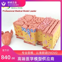 ENOVO Medical Human tongue anatomy model Tongue coating Tongue papilla Taste buds Oral gastroenterology teaching