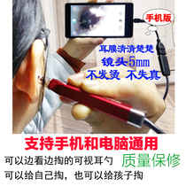 Visible ear spoon glowing ear spoon otoscope mobile phone computer universal visual ear ear picking tool