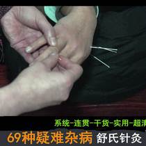 202021 New finishing full set of Shus acupuncture 69 Acupuncture-Moxibustion 69 Advanced Real Combat Class Nameplate Dry Goods Case Real Gymnastics System Diagnose Chinese Medicine Teaching Techniques Training Needle Farcolor Supervideo