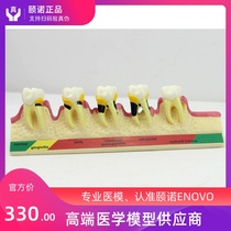 ENOVO Oral Periodontal disease classification model Gingivitis Chronic periodontitis Dentist communication