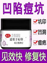 (Buy 2 get 1) acne pit hole repair male lady to remove acne acne scars