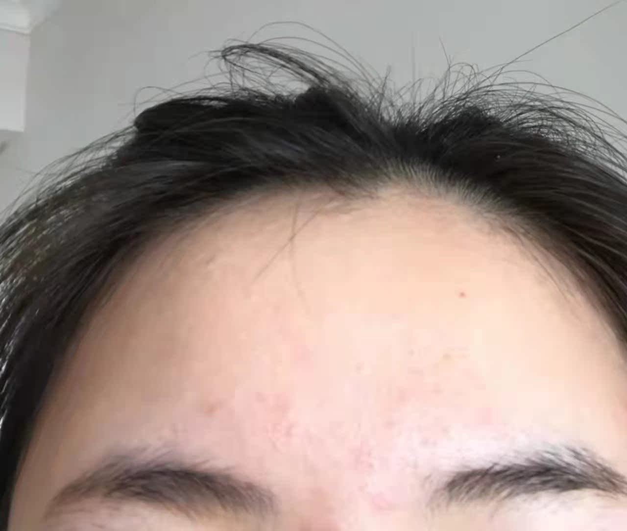 良心点评仁和匠心祛痘乳液/面霜好不好呢？剖析怎么样？使用评测曝光