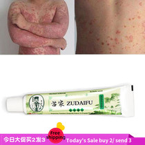 Skin Psoriasis Cream Dermatitis Eczematoid Eczema Ointment