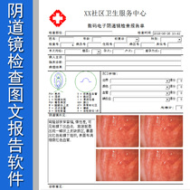 Digital electronic colposcopy software Colposcopy image medical record collection report printing and storage system