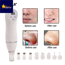 6 Tips Diamond Dermabrasion Peeling Machine Facial Skin Care