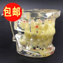 Dental Oral teaching model Childrens pathological model Baby teeth permanent teeth alternating transparent crystal model 