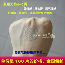 Acupoint post-buried line postoperative post-weave non-woven round creation appliable without cotton core anti-wear foot sticking with 100 pieces